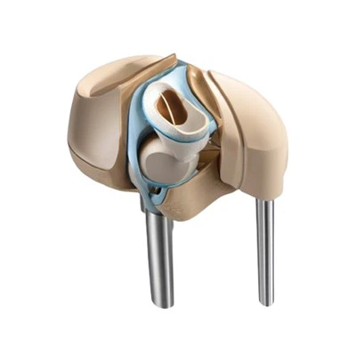 Penggantian Lutut Artritis